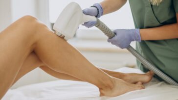 Laser epilation, hair removal therapy