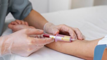 Blood Test Home Service