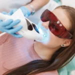 Teeth Whitening in Dubai Deira