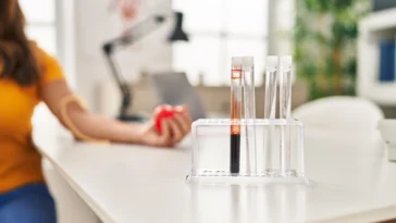 Lab Test At Home Dubai