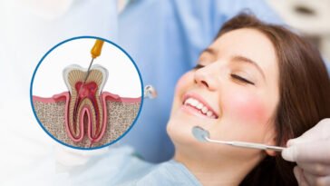 root-canal-cost-houston