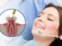 root-canal-cost-houston